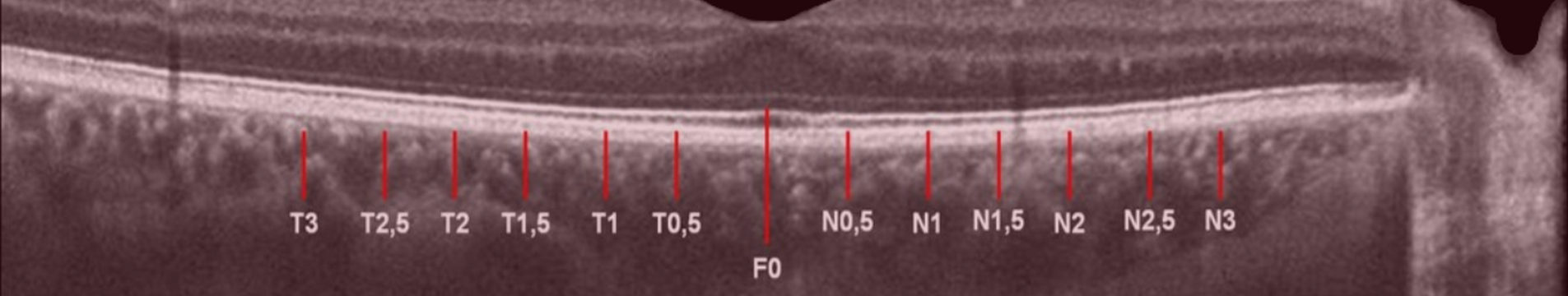 pg curso nomenclature